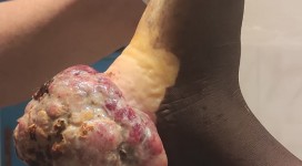 thumbnail_c5236bbe-0559-45a9-9ef6-7fafdd92c3f7